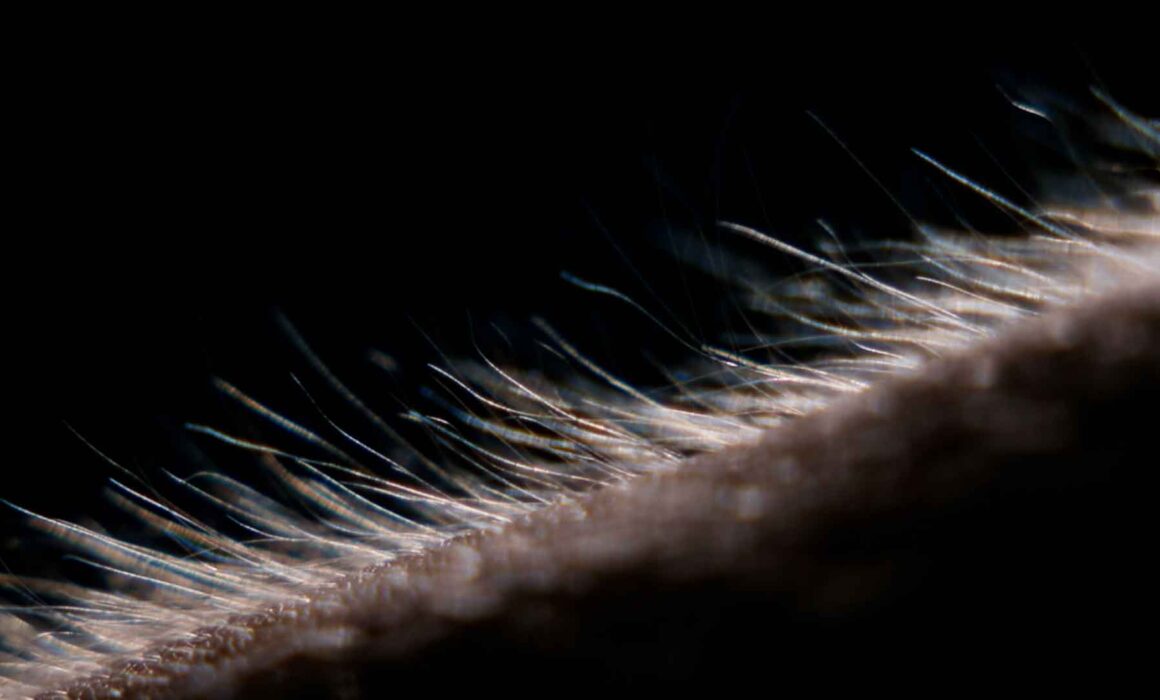 Headerbild Arm mit Haaren